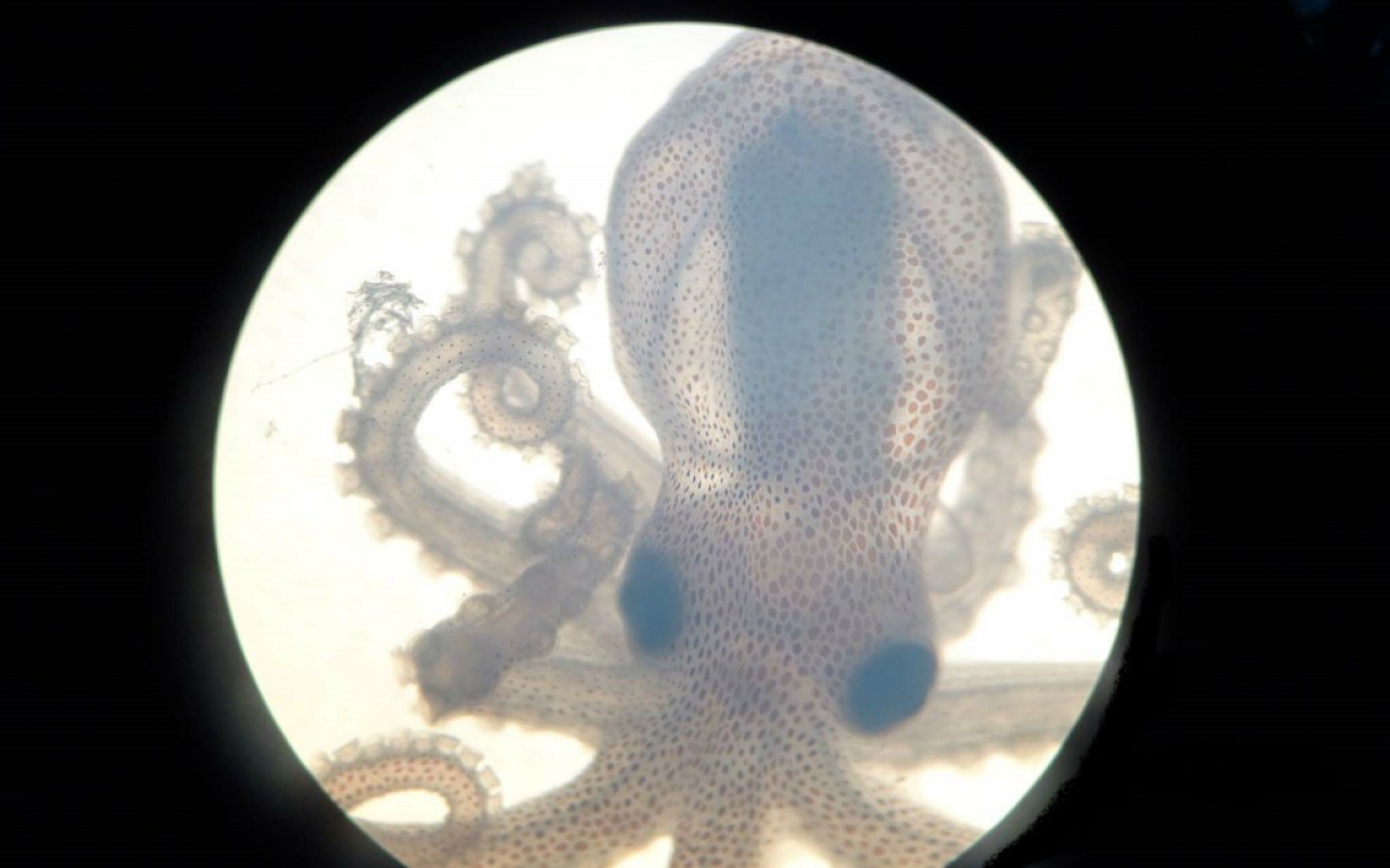 Pulpos bajo microscopio